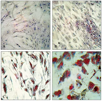 Fig. 1. Oil Red O staining of SGBScells at (A) Day 0 and at (B) Day 4,(C) Day 10, and (D) Day 20 afterdifferentiation.Thestainedlipiddroplets are shown in red.