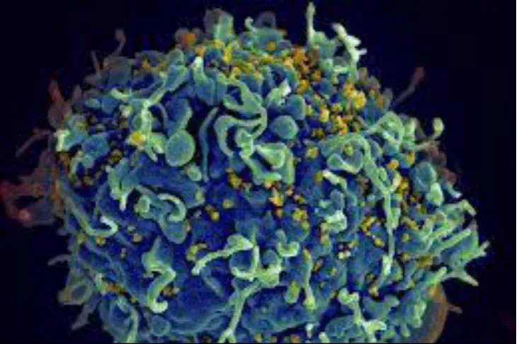 Figure 1 :THE AIDS VIRUS 