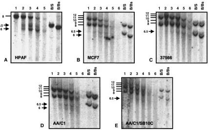 Fig. 3.Detection of the �750 and �250 DHS in chromatin from cell lines. Southern blot of DNase I digested chromatin from (A) HPAF, (B) MCF7, (C) lymphoblastoid (37566), (D) AA/C1, (E) AA/C1/SB10C cleaved with BamH I and hybridised with 5’MUC1probe