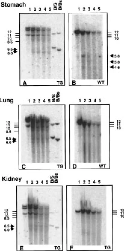 Fig. 4.Expression of 656 bp fragment and for 572 bp fragment.MUC1 in the cell lines analysed inﬁgure 3