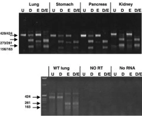 Fig. 6.Detection of the expression of the human U denotes uncut, D/E double digestion with both enzymes; WTwild type C57BL6 mice