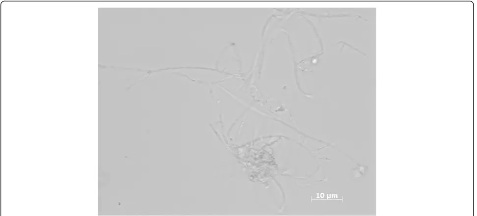 Figure 11 Filamentous structures in the floating layer sample (×100 magnification).