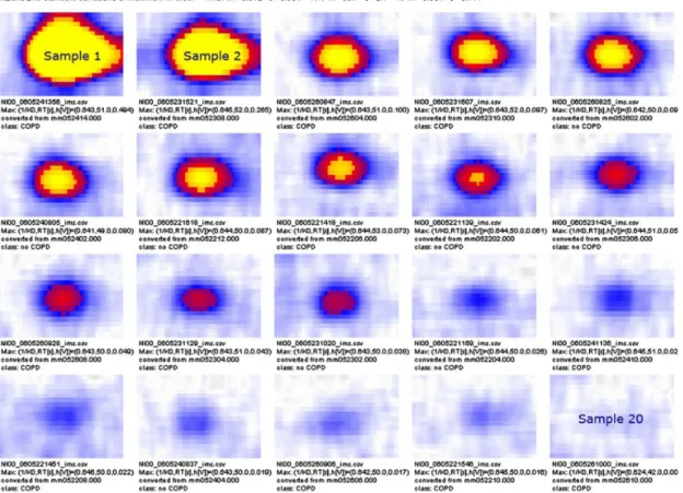 Figure 2.5.: Peak comparison of a marked area in 20 different samples of human breath ordered by signal intensity from the  up-per left (highest value) to lower right (no relevant signal intensity) [36].