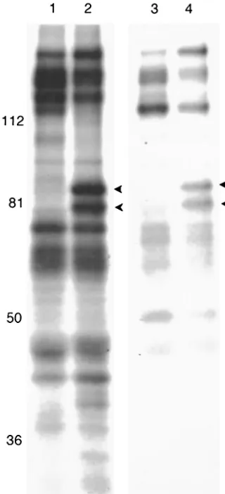 FIG. 2. Scanned digital image of ﬂuorograph of radiolabeled pro-teins electrophoretically separated on an 8% polyacrylamide gel.