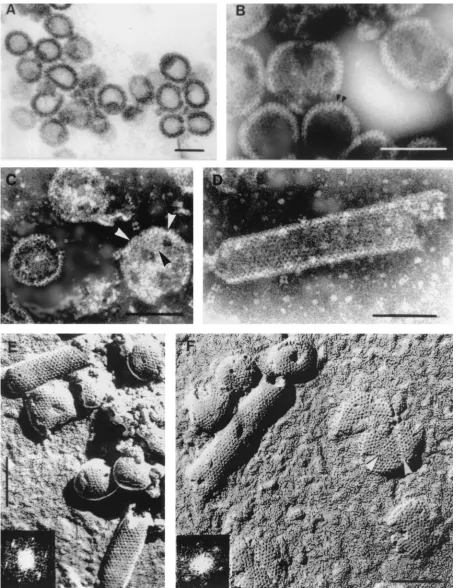 FIG. 1. (A). Thin section of �sodium silicotungstate (pH 8.2). Arrowheads point to peripheral rod-like projections