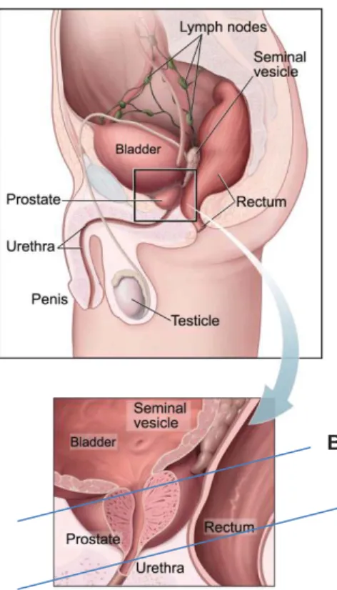 Figure 1.1 shows the anatomy of the prostate in relation to other pelvic structures. Inset  figure shows an enlarged view along with the base and apex