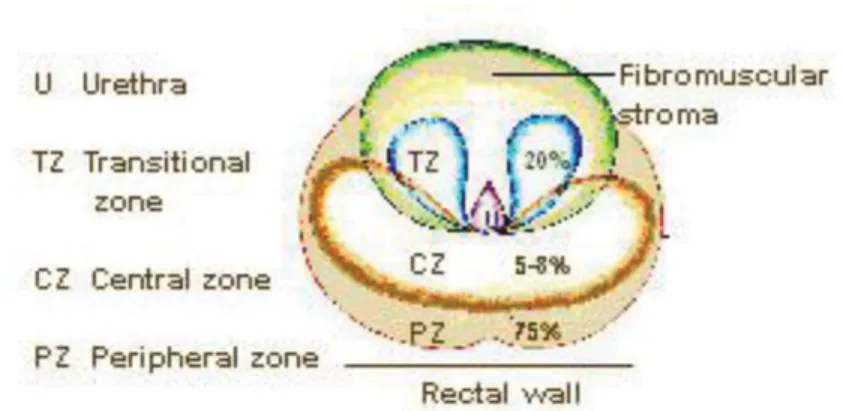 Figure 1.2 shows an  axial view of the prostate showing zonal anatomy. The central  gland (CG) as defined in this thesis (not shown in figure) is composed of everything  other than PZ (i.e