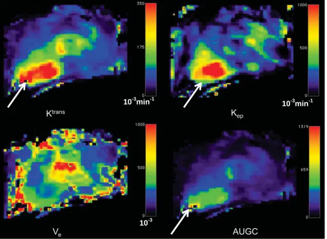 Figure 2.5 DCE-MRI maps of the prostate. Units of the scale bar are 10 -3  × min -1  (K trans ),  10 -3  × min -1 (K ep ) and 10 -3  (V e )
