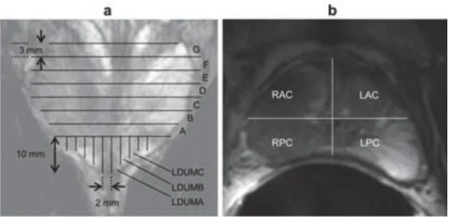 Figure 2.7 Diagrams of pathologic sectioning protocol overlaid on a coronal (a) and axial  (b) T 2 w image