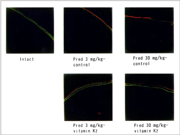 Fig. 4. Three-dimensionalμCT images of the proximal tibial metaphysis in rats [Adopted from the reference 46]