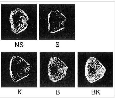 Fig. 6. Two-dimensional CT images of the femoral distalphosphonate and vitamin Ksinglebisphosphoantecellous bone loss