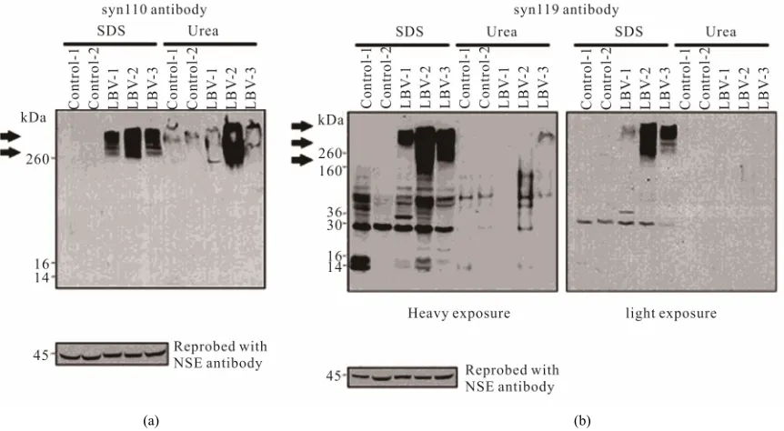 Figure 4. C-terminally truncated forms of alpha-synuclein are present in post mortem brain tissue