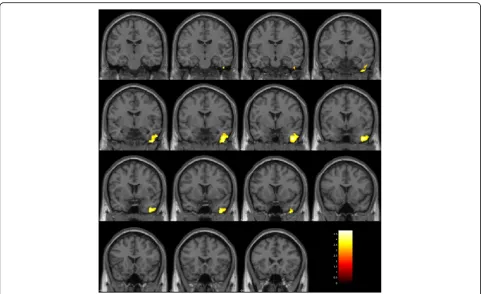 Fig. 3 Brain regions of low gray matter volume in the impulsive group. The initial voxel threshold: uncorrectedcorrection, and a cluster-corrected p(FWE) < 0.05