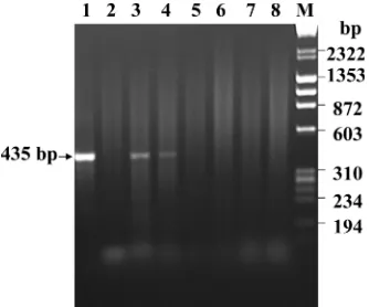 FIG. 6. PCR ampliﬁcation of BHV-5Us9�DNA; lane 2, PCR product from olfactory bulb of normal rabbit brain; lanes 3 and 4, PCR product from olfactory bulb of rabbits 1 and 2,respectively, infected with BHV-5 Us9R; lanes 5 to 8, PCR product from olfactory bul