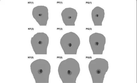 Table 1 Canal volume increase and canal transportation of K-files, PathFiles and the ProGlider file groups after glide pathpreparation (mean ± standard deviation)