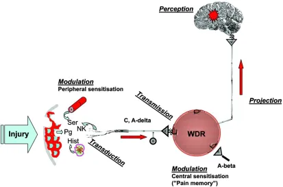 Figure 4.1 Pathophysiology of pain 