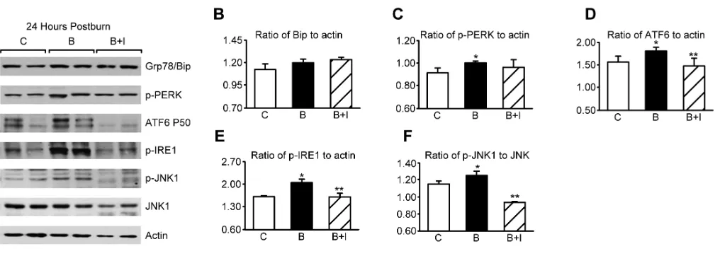 Figure 2. Insulin decreases hepatic ER stress 24 h after burn injury. (A) Representative Western blots from control (C), burn (B), and burn +insulin (B + I) liver lysates 24 h after burn injury