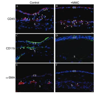 Figure 7. Recruitment of inflammatory cells to the operated site of control versus MMC-cells in the conjunctival epithelium and episclera region of the control operated area (A, arrowheads) while in the MMC-treated operated site, they were detected mainly 