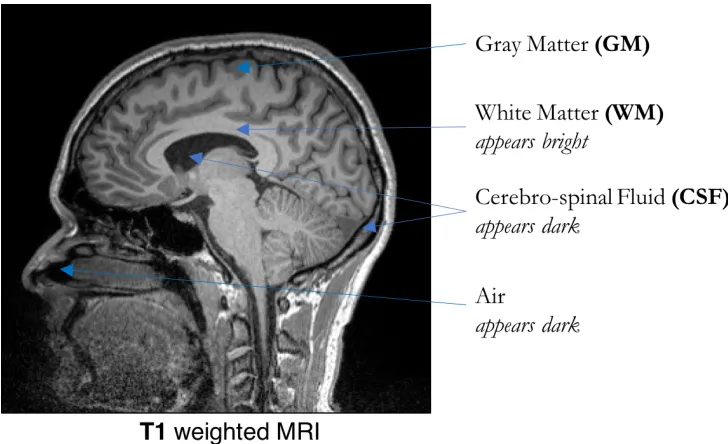Figure 2.1: Sagittal view of a T1 weighted brain MRI. 