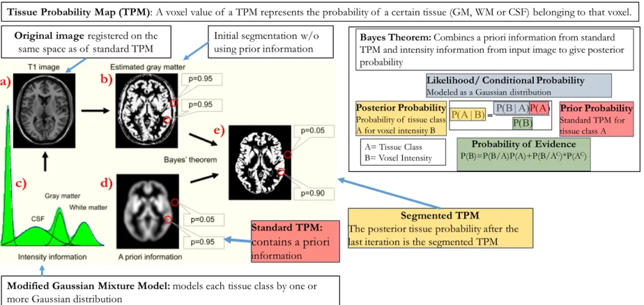 Figure 2.3: SPM Tissue Segmentation. 