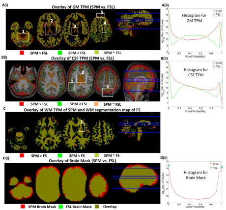 Figure 3.3: Inter-method segmentation comparison 