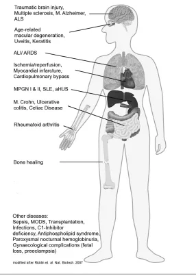 Figure 5. Scheme of diseases in which complement has a major impact. ALS, amy-otrophic lateral sclerosis; ALI, acute lung injury; ARDS, adult respiratory distress syndrome;MPGN, membranoproliferative glomerulonephritis; SLE, systemic lupus erythematosus;aH