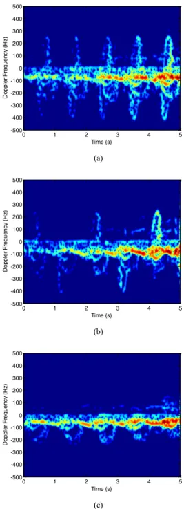 Fig. 3. Spectrogram of three kinds of human gaits. (a) Walking with no bag. (b)  Walking with one bag held by one hand
