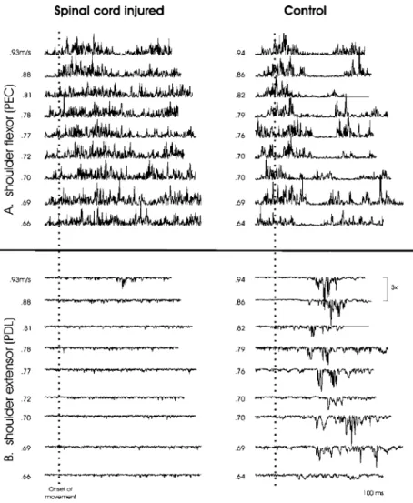 Figure 5 illustrates the EMG patterns for shoulder agonist and antagonist muscles across a range of speeds.