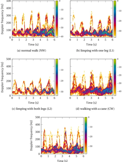 Figure 5.3: Examples of spectrograms for different walking styles toward the radar system
