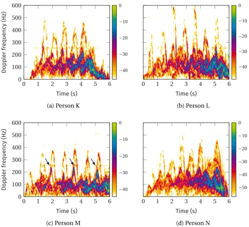 Figure 5.5: Example micro-Doppler signatures of individuals with diagnosed gait disor- disor-ders walking toward the radar