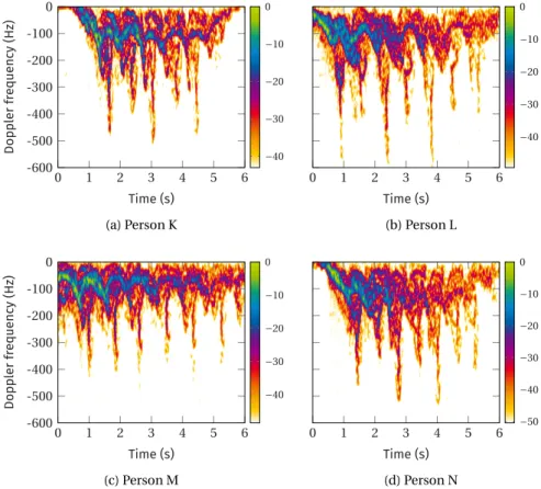 Figure 5.6: Example micro-Doppler signatures of individuals with diagnosed gait disor- disor-ders walking away from the radar