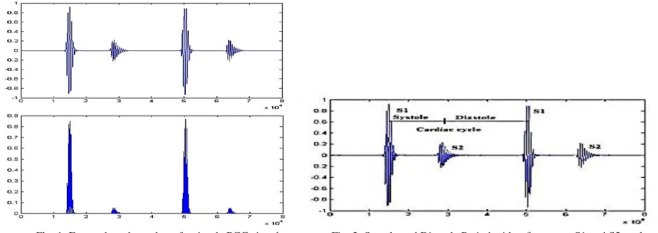 Fig .1: Energy based envelop of a simple PCG signal   Fig. 2: Systole and Diastole Period with reference to S1 and S2 peaks