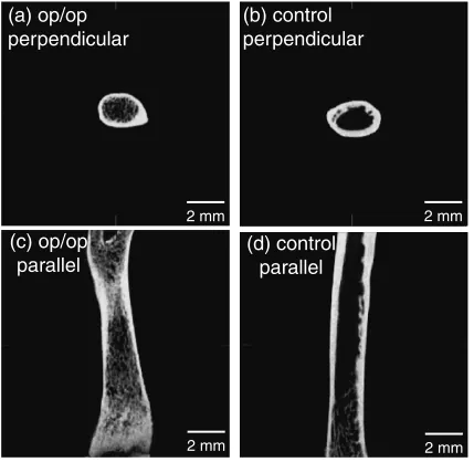 Fig. 4X-ray micro-CT images perpendicular and parallel directions to longitudinal bone axis in femurs of op/op and control mice:(a) op/op mouse, perpendicular direction, (b) control mouse, perpendicular direction, (c) op/op mouse, parallel direction, (d) controlmouse, parallel direction.