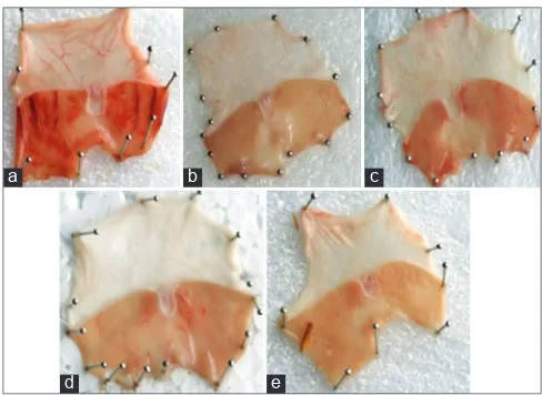 Figure 1: Stomach of rats (a-e). (a) - Stomach treated with 1 ml absolute ethanol, (b) - the stomach treated with esomeprazole 10 mg/kg and 1 ml of absolute ethanol p.o., (c-e) - treatment with 75, 150 and 300 mg/kg of Saponin (fraction) of Trichopus zeylanicus and 1 ml absolute ethanol, p.o., respectively