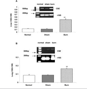 Figure 2. Liver (A) and lung (B) CSE mRNA expression in normal, sham and burn group (n =5 animals/group)