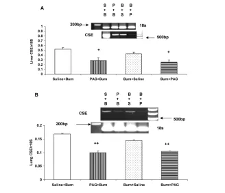 Figure 5. Effect of PAG administration on liver (A) and lung (B) CSE mRNA expression inmice with burn injury (n = 5 animals/group)