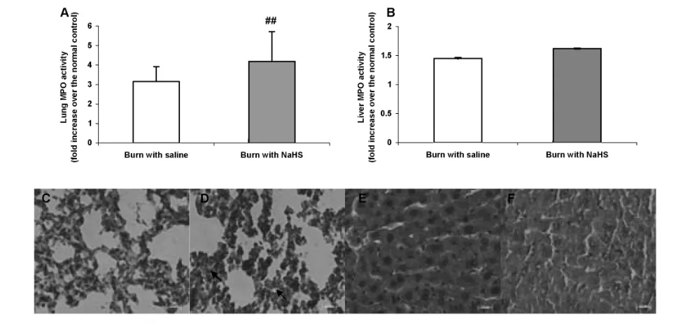 Figure 6. Effect of Hthickness (arrow) can be easily detected. (E) Liver from mice subjected to burn injury with saline simultaneously; (F) liver from mice sub-jected to burn injury with NaHS simultaneously