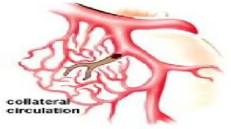 FIG.4  COLLATERAL CIRCULATION 