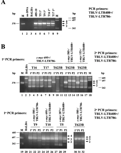 FIG. 3. PCR analysis of tumor DNAs to determine the number of 62-bp repeats in the TBLV LTR enhancer