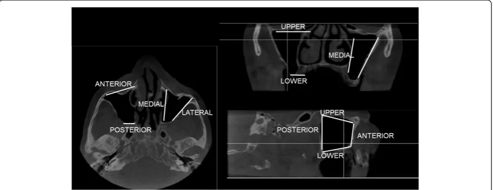 Figure 1 The locations of the abnormalities were recorded using orthogonal view of maxillary sinus.
