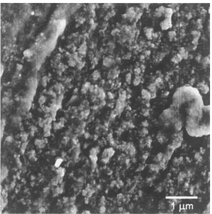 Fig. 8MgAl2O4 crystals grown on the surface of an Al2O3 particle in the4 vol% Al2O3/Al-1.0 mass%Mg2Si metal-matrix composite: (a) SLEEMmode at the landing energy of 1 keV and primary energy 10 keV, (b)standard SE image at 10 keV; width of the ﬁeld of view 3 mm.