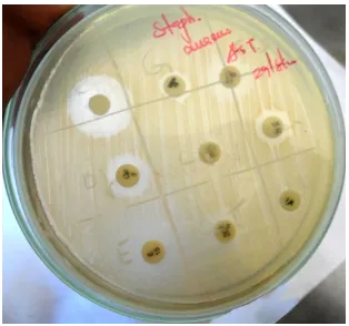 Fig. 3: Mueller Hinton Agar Plate showing Staphylococcus aureus 
