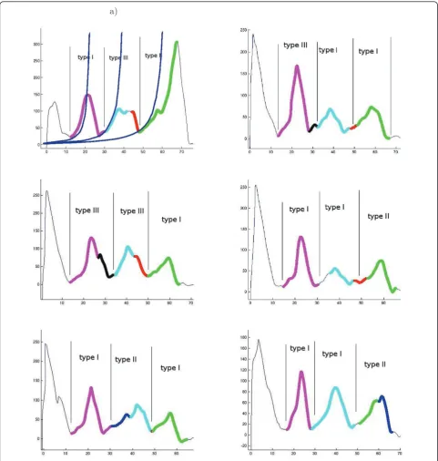 Figure 9 In bR there are three main unfolding events, which are detected in F-D curves as main peakscorresponds to an unfolding of helices in the bR structure.map the unfolding event to a specific amino acid in the structure [13,20,22]