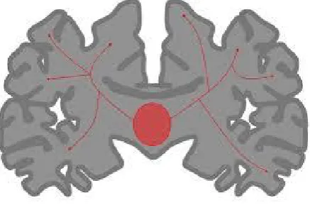FIGURE 1: Cross section of brain showing primary generalized seizure 