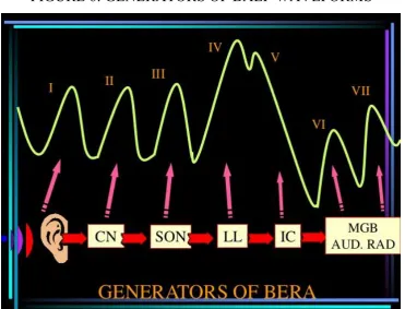 TABLE 1: Generators of BAEP waveforms 