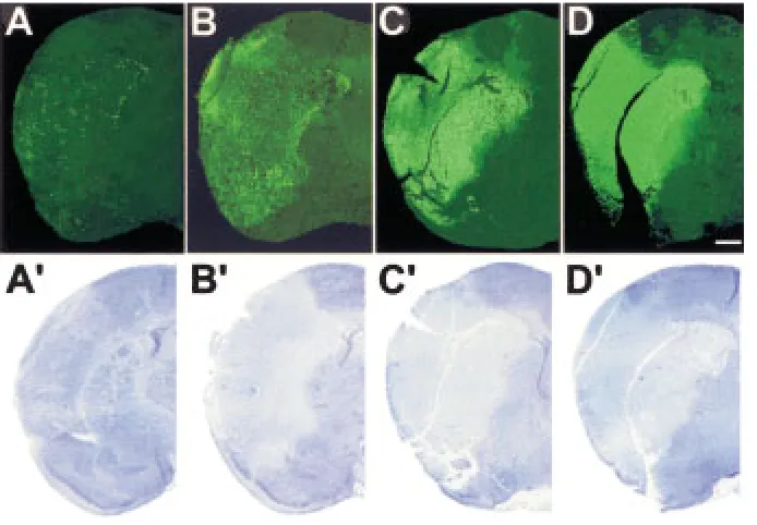 Fig. 3.Detection of lethally damagedcells at the boundary of stroke by insitu ligation at 6 and 72 hr after theonset of ischemia