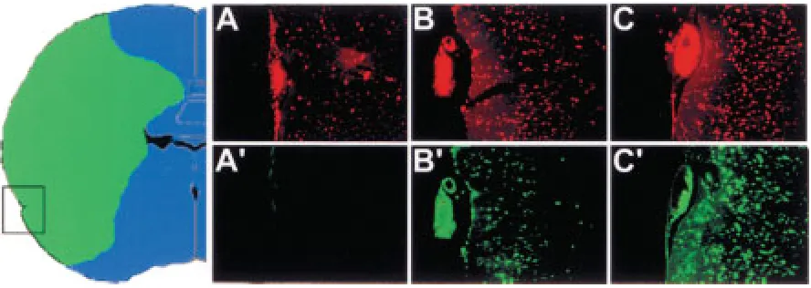 Fig. 4.Dual detection of DNA breaks using TUNEL (A, B, C) and in situ ligation (Aindicates the general area from which the images were taken (Bar, 100 24 hr (B, B6 hr after ischemia onset and gradually proceeds toward lethal DNA damage at later times of is