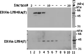 FIG. 6. Immunoblot of transfected-cell proteins bound to GST orchimeric GST-EBNA-LPR1, electrophoretically separated in a dena-
