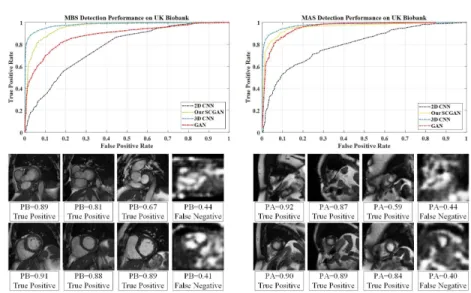 Fig. 2. MAS and MBS detection performance (Top) and sample test slices and their probability values (Bottom)