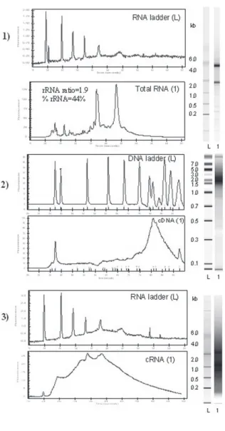 Figure 1. Quality control (QC) of the reactionproducts for microarray analysis. 1. Evaluationof RNA integrity for an individual RNA HCV-HCC sample (sample 5)